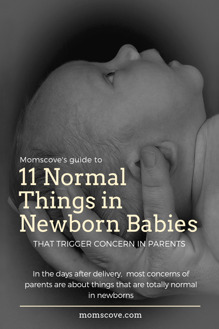  11 Normal Things In Newborn Babies That Trigger Concern In Parents