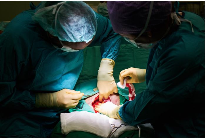 Surgeons performing a cesarean section 